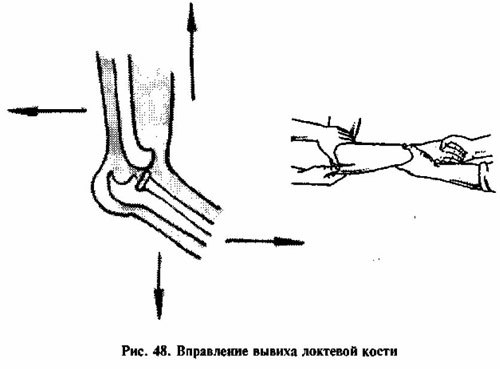 Вывих левого локтевого сустава карта вызова