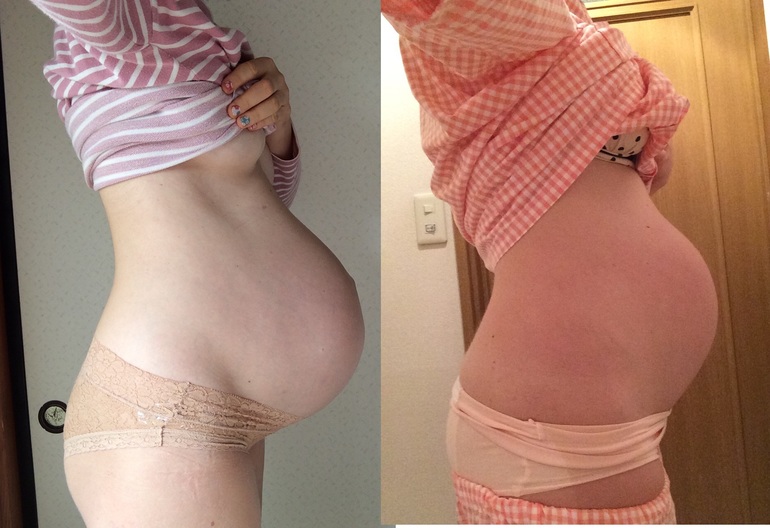 1 5 месяца после родов