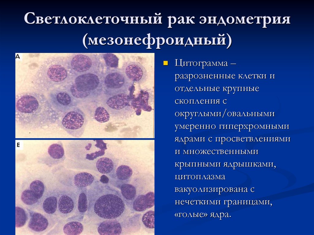 Цитологическая картина воспаления