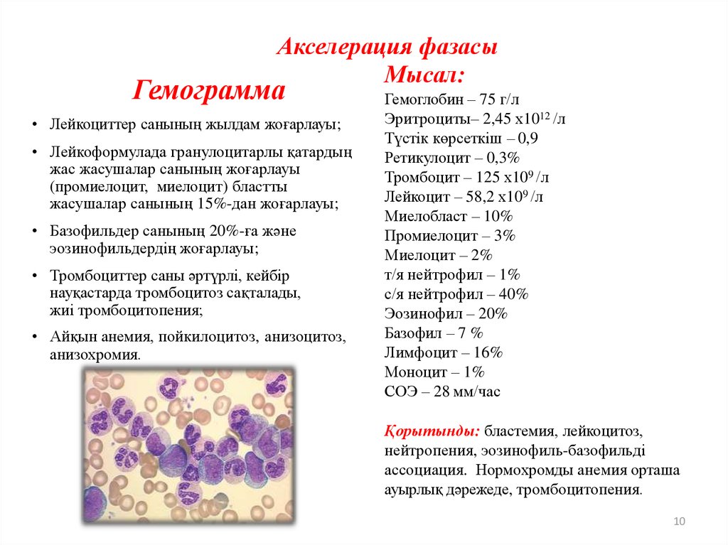 Общий анализ крови лейкоцитоз
