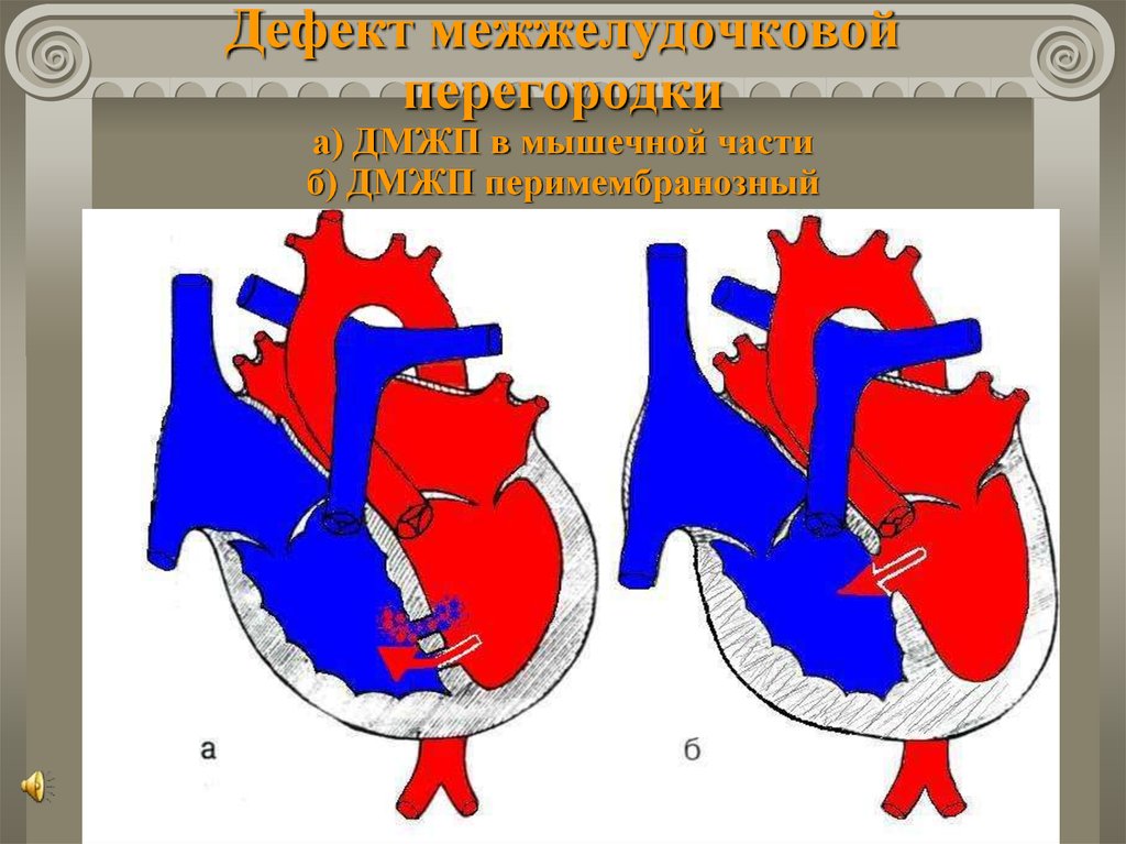 Гемодинамика дмжп у детей схема