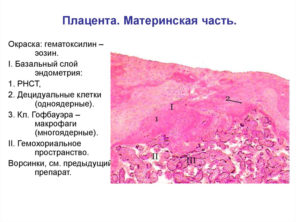 Трубная беременность микропрепарат рисунок