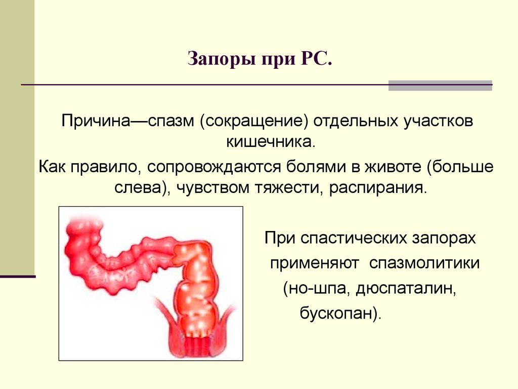 Выпадение прямой кишки презентация