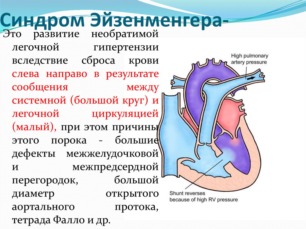 Презентация пороки сердца у беременных презентация