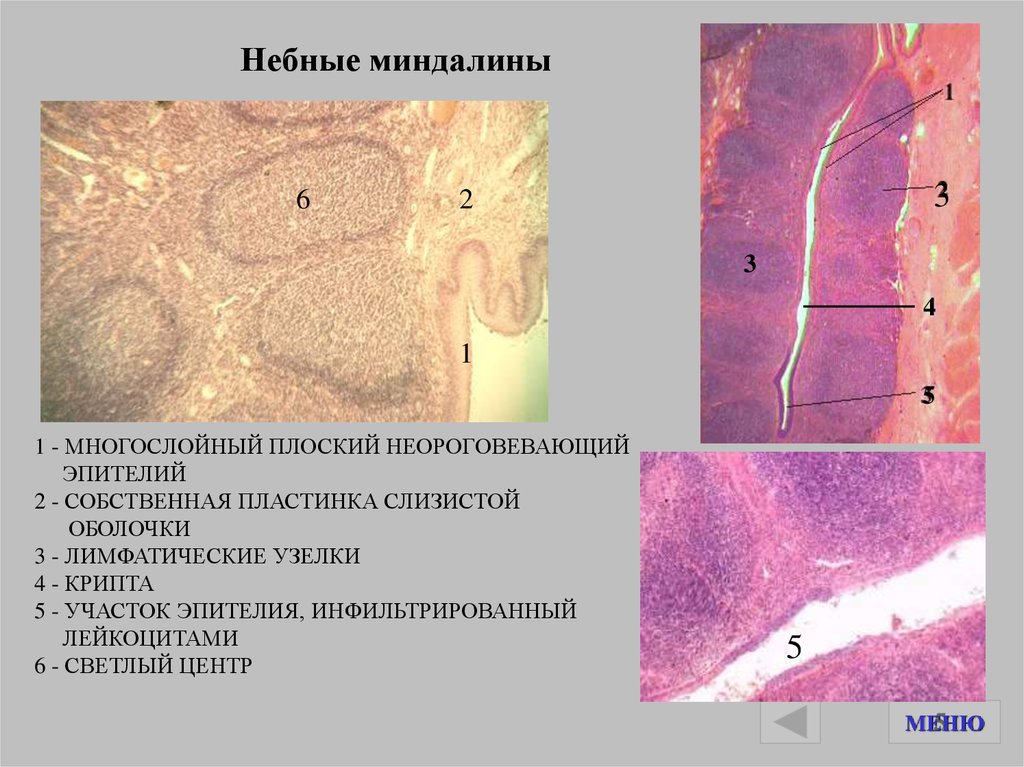 Небная миндалина гистология рисунок