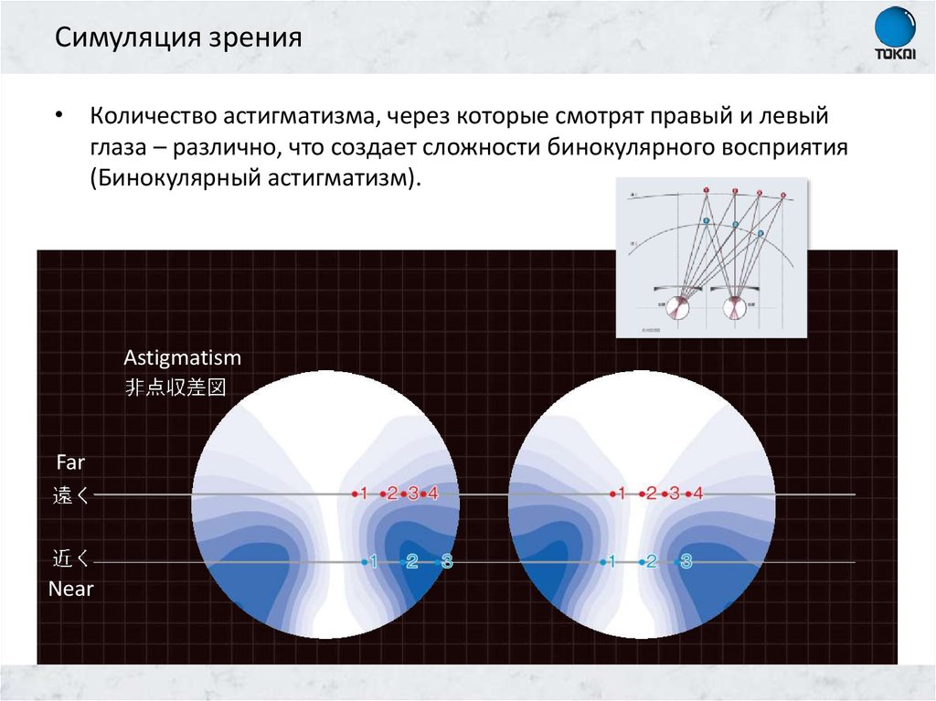 Нарушение бинокулярного зрения в результате которого происходит раздвоение изображения астигматизм