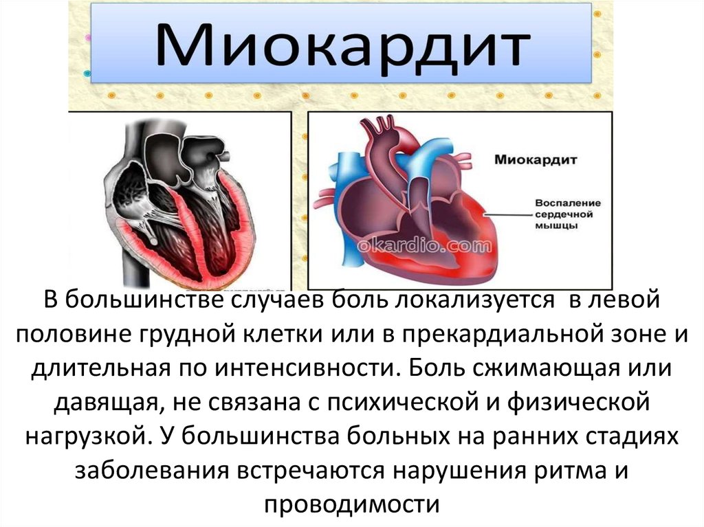 Эндокардит миокардит перикардит презентация