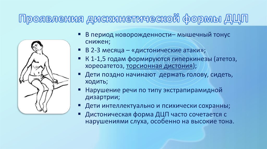 Д ц п. Гиперкинетическая форма ДЦП симптомы. Дискинетическая форма ДЦП. Дискинетический церебральный паралич, гиперкинетическая форма.