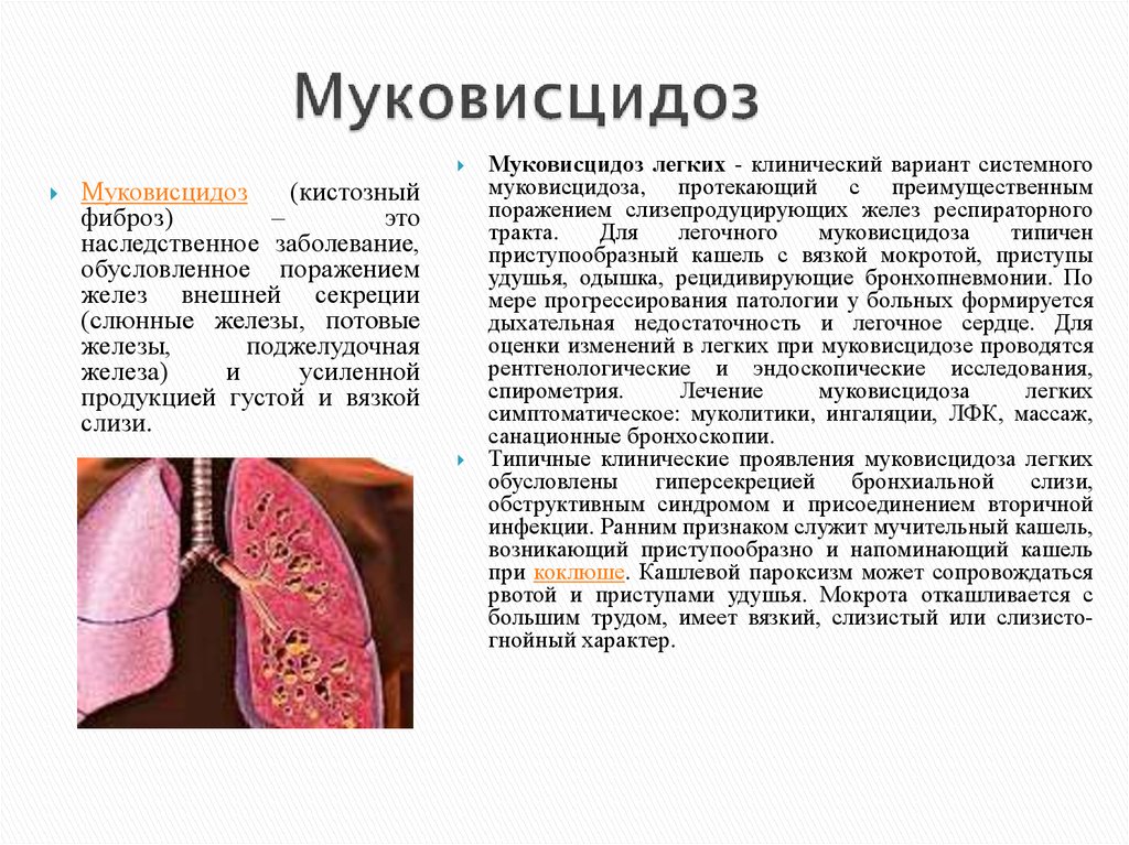 Лечение муковисцидоза презентация