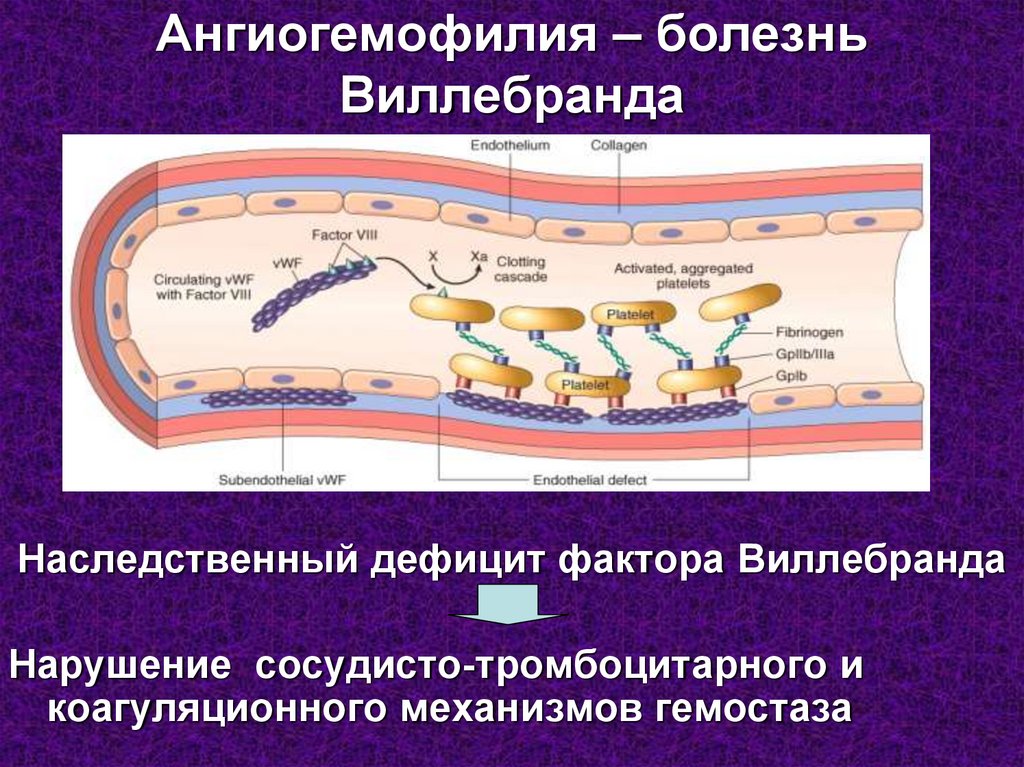 Болезнь виллебранда презентация