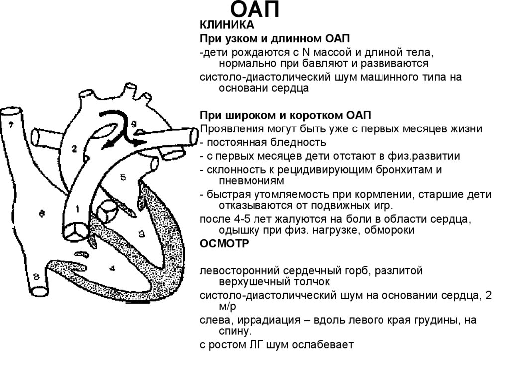 Оап у новорожденных. Открытый артериальный проток (ОАП). Открытый аортальный проток гемодинамика. Порок сердца открытый артериальный проток.