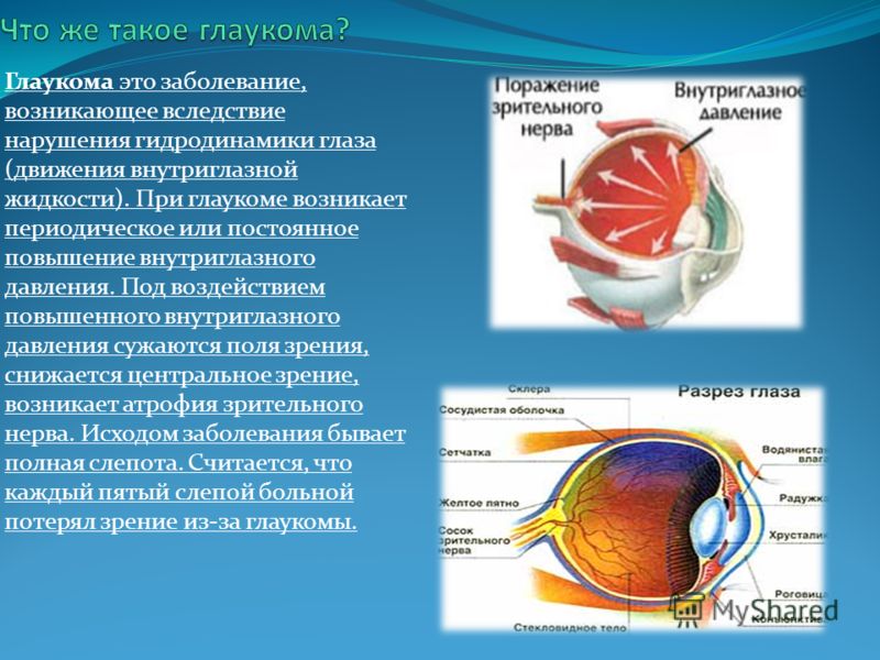 Признаки глазного давления. Гидродинамика глаза глаукома. Глаукома, повышенное внутриглазное давление. Повышение внутриглазного давления (глаукома).. Презентация на тему глаукома.