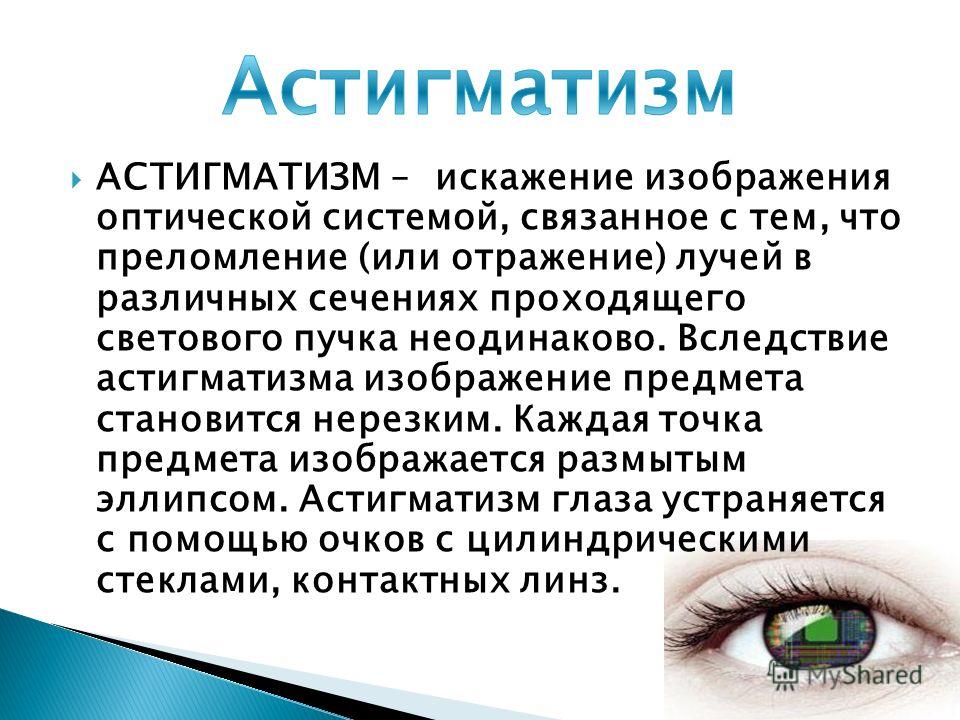 Астигматизм что это такое. Астигматизм 4.5. Астигматизм искажение. Астигматизм презентация. Астигматизм глаз у взрослых симптомы.