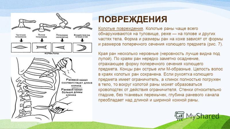 Колющий написать. Инфицированная колотая рана.