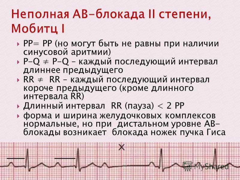 Неполная блокада предсердия. Неполная блокада. Синусовая аритмия у детей.