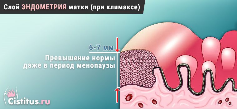 Эндометрий матки размер. Толщина матки при менопаузе. Эндометрия матки в менопаузе УЗИ. Норма эндометрия матки в менопаузе.