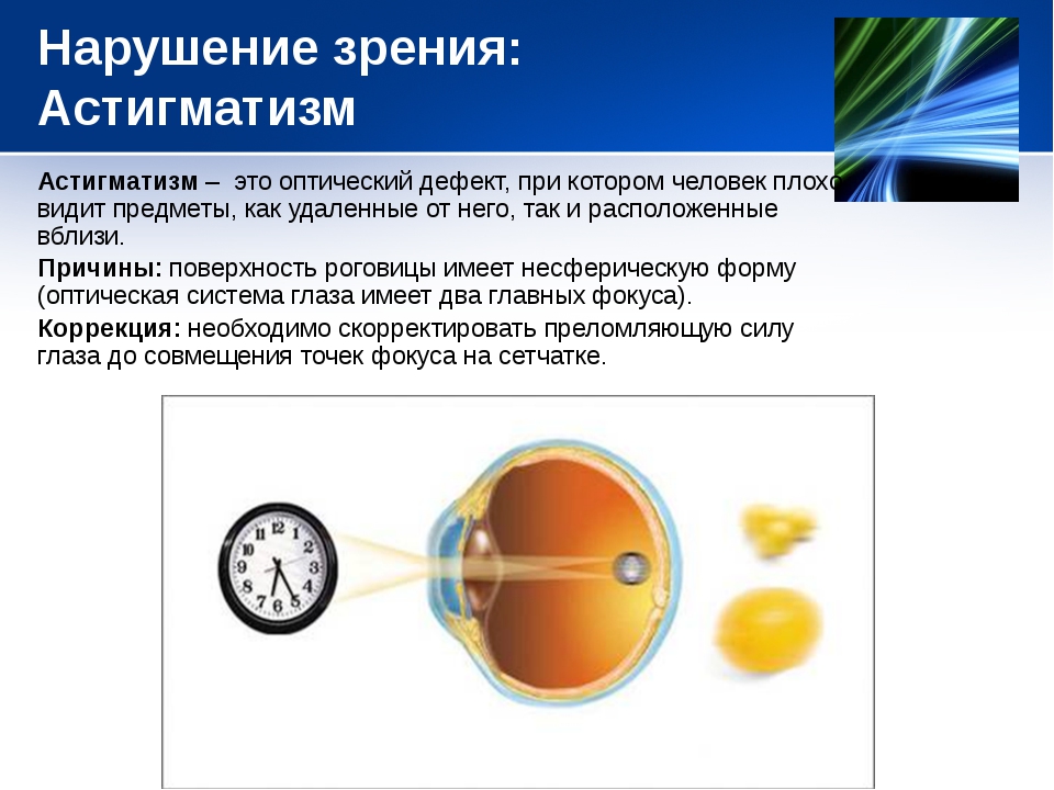 Презентация на тему нарушения зрения профилактика нарушения зрения