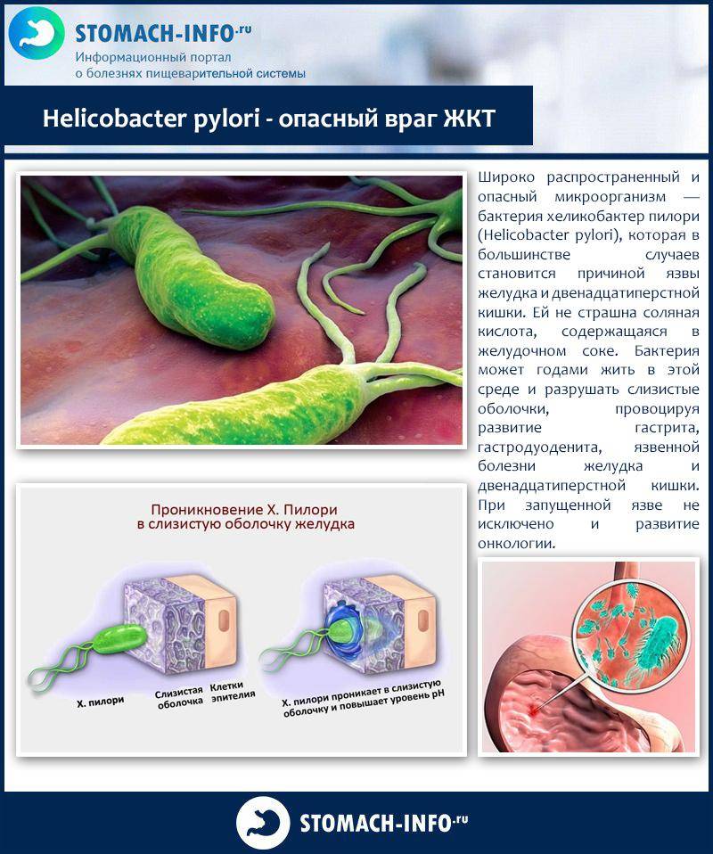 Хеликобактер пилори в картинках