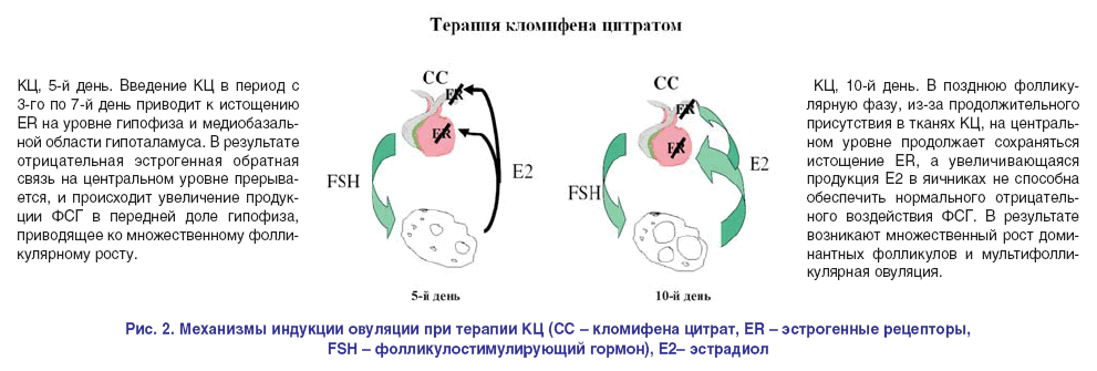 Клостилбегит схема стимуляции овуляции